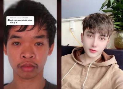 این پسر ویتنامی بعد از اینکه به خاطر قیافه اش در مصاحبه کاری رد شد، 17 هزار دلار هزینه کرد تا با جراحی های پلاستیک، چهره اش را به کلی عوض کند!